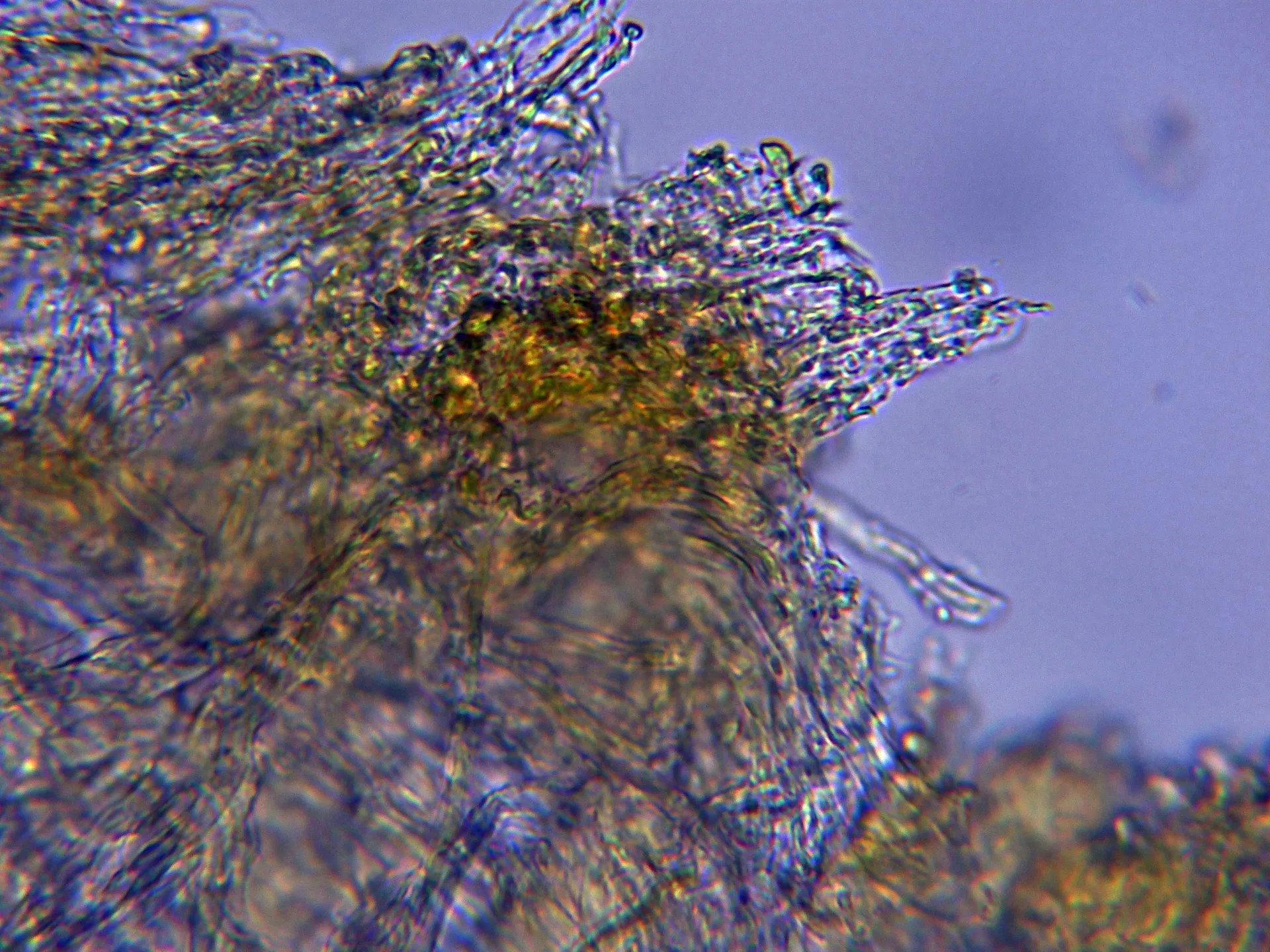 Microscopía de Mycoacia gilvescens - 10 - Hifas con incrustaciones Melzer-001